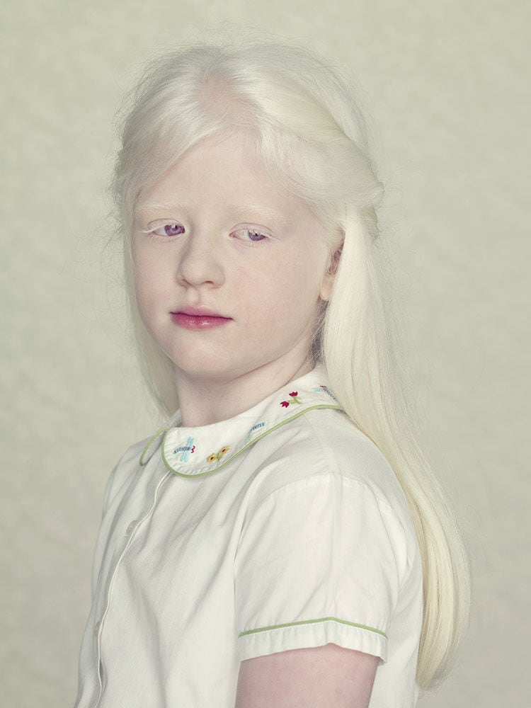 Stunning Portraits Of Albinos By Gustavo Lacerda Freeyork