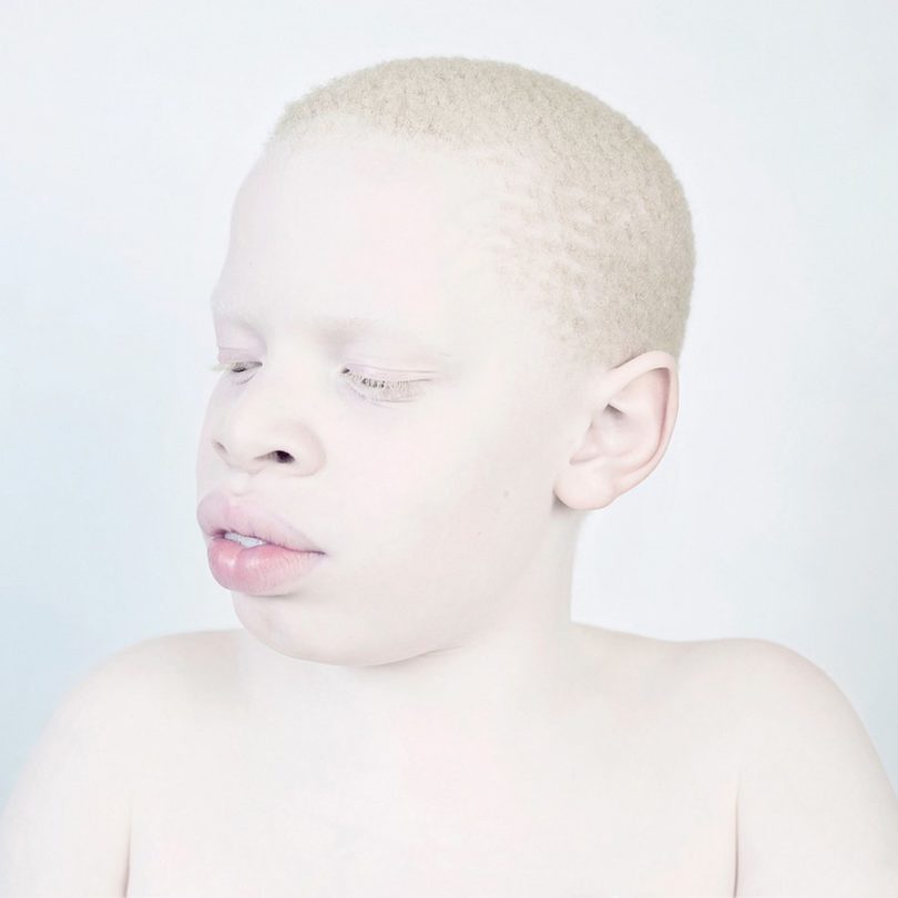 Fragile Snow White Portraits Of Albinos By Sanne De Wilde Freeyork