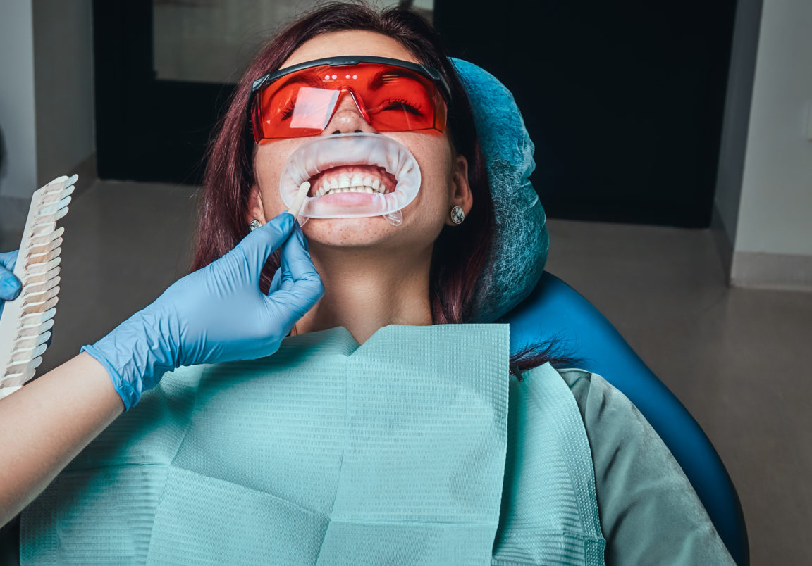 a woman dentist checks the level of teeth whitenin J6C3BS2