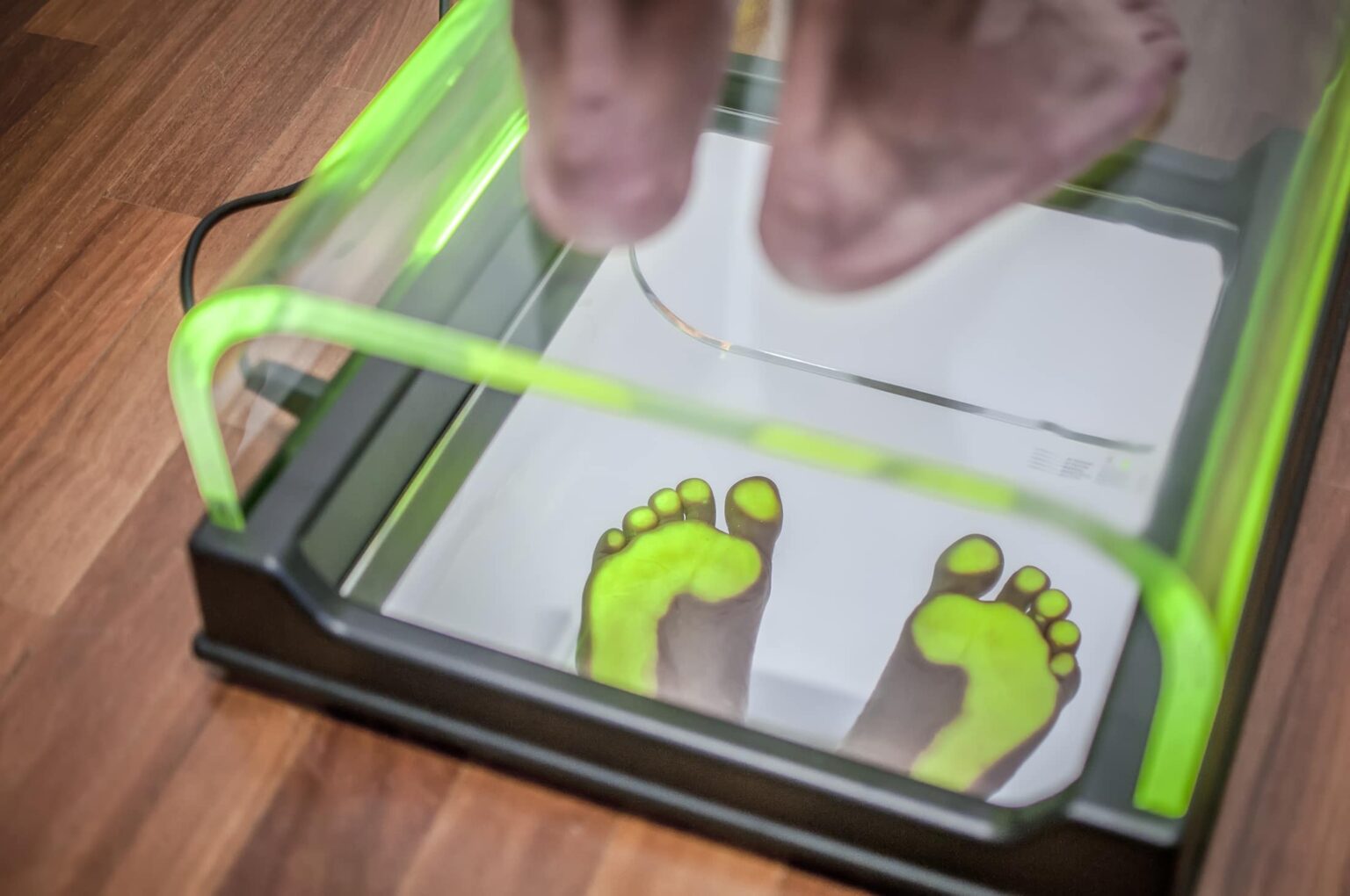 Can Flat Feet Cause Foot And Back Pain? FREEYORK