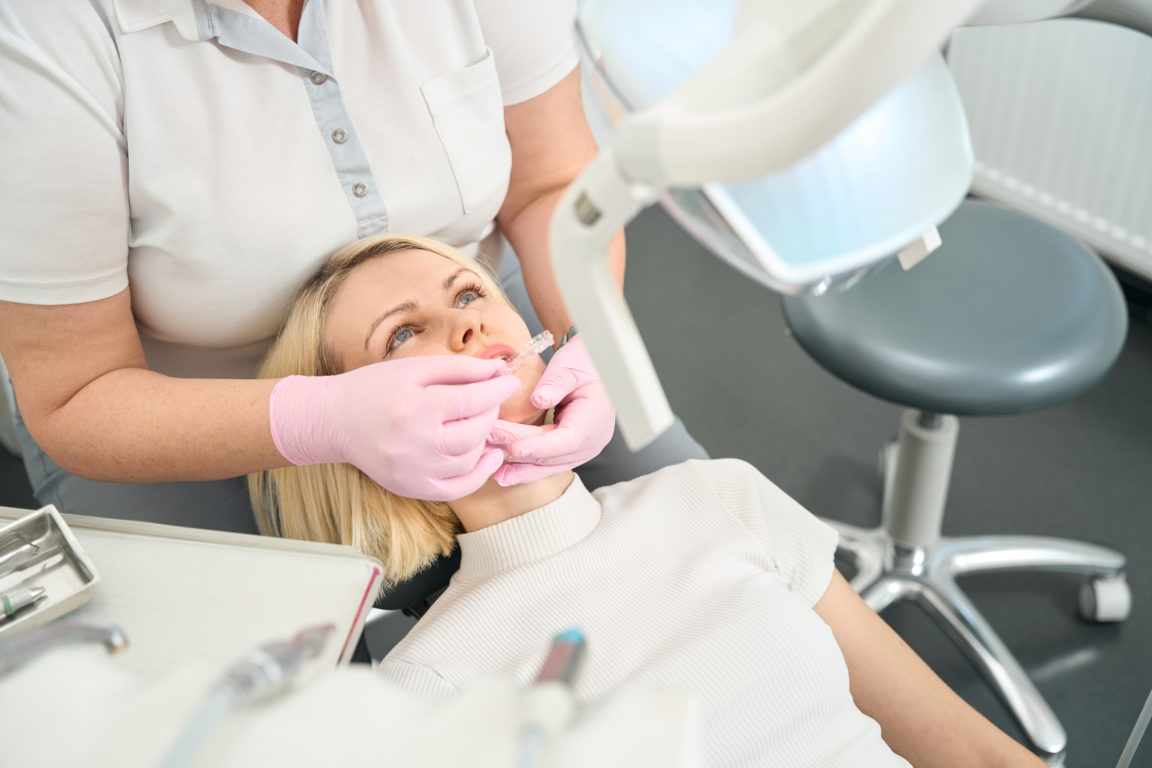 woman dentist putting aligners on her teeth 2022 10 10 16 21 36 utc