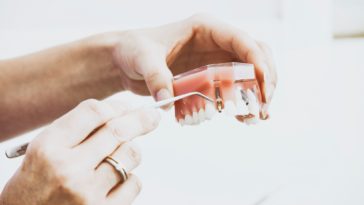 person wearing silver-colored ring while holding denture